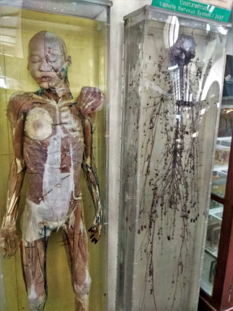 The Anatomy Museum, Siriraj Museum, Bangkok