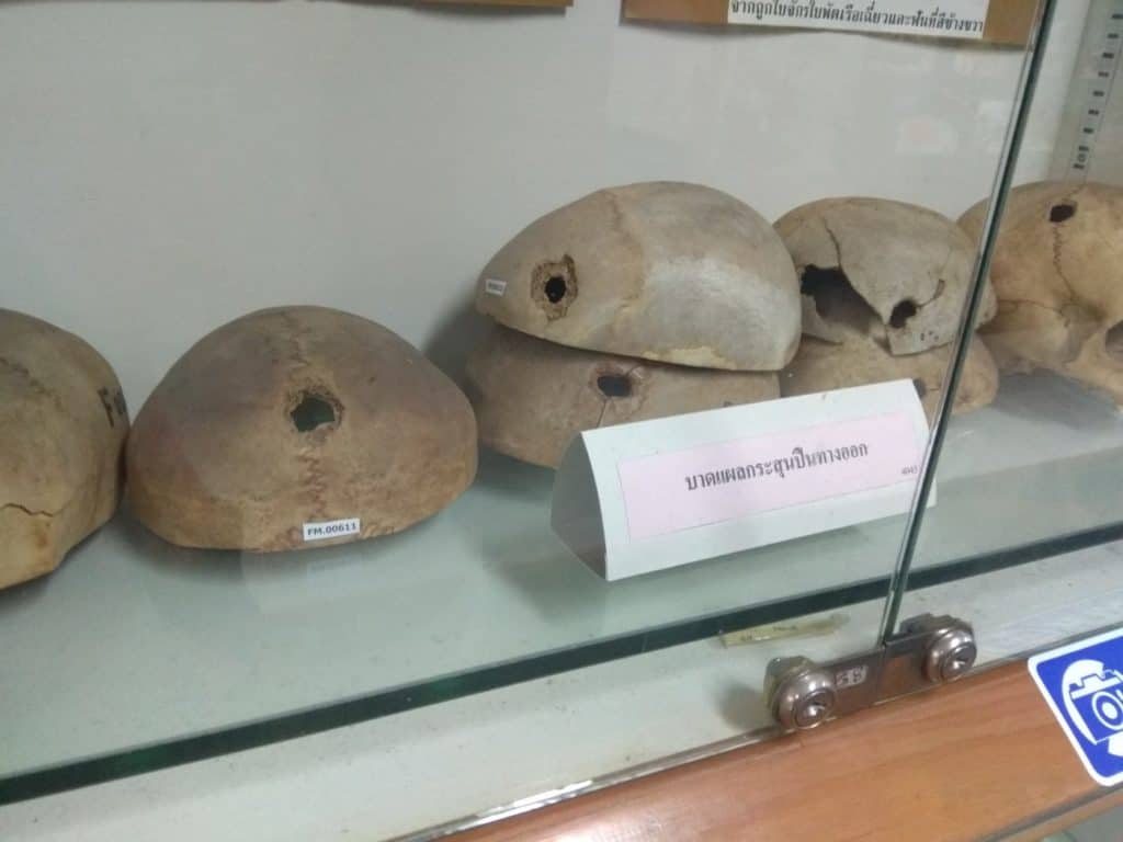 Skulls with bullets' holes at the Forensic Museum